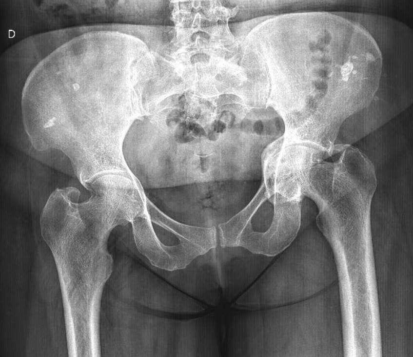 JuanMiranda tweet media