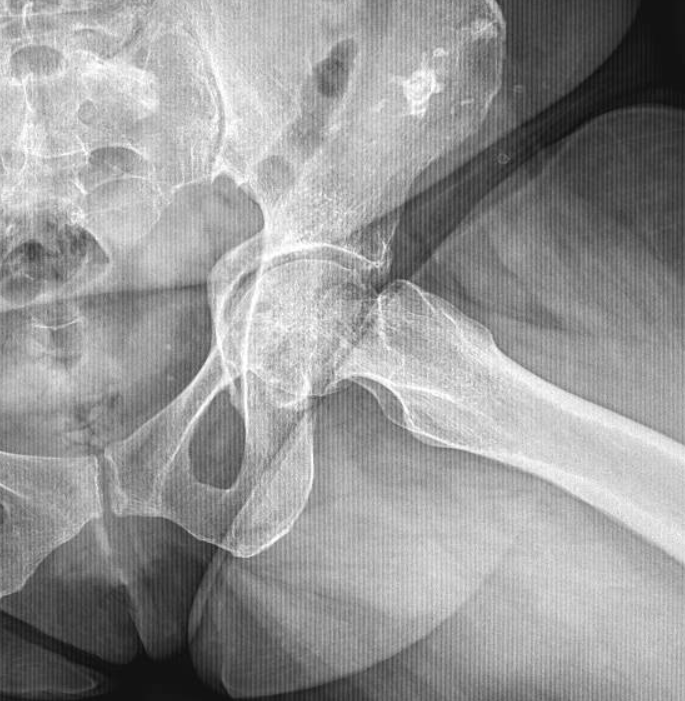 JuanMiranda tweet media