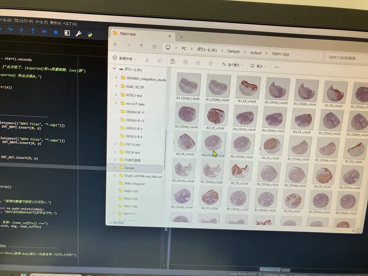 Ferretpathol's tweet image. pythonでTMAのWSIからAnnotationでコアを括って、一括で画像ファイルにすることに成功