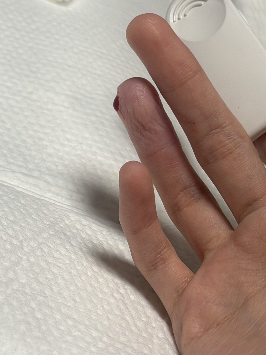 RIPRARAA tweet media