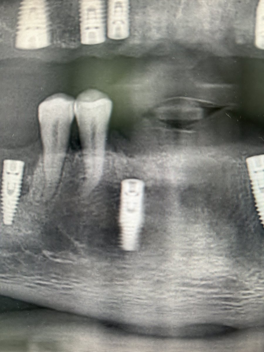 BrontoslavC's tweet image. 