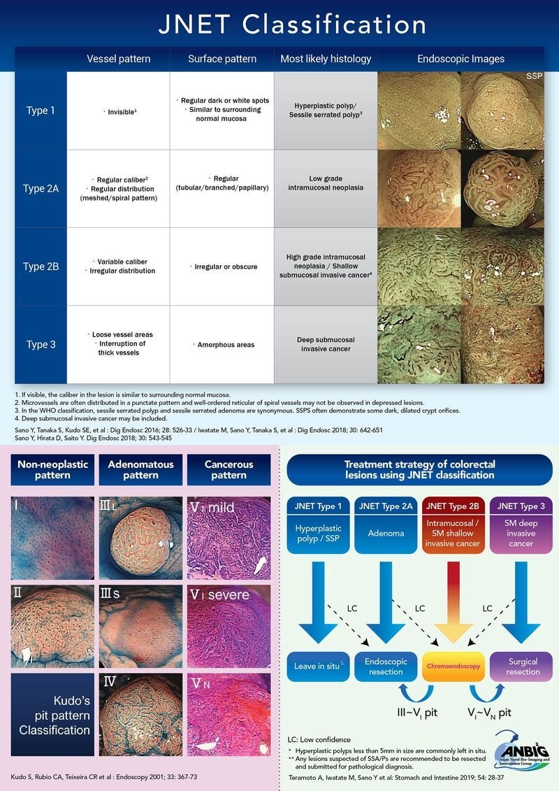 EndoCollabcom's tweet image. Dissecting 𝘁𝗵𝗲 𝗝𝗡𝗘𝗧 𝗰𝗹𝗮𝘀𝘀𝗶𝗳𝗶𝗰𝗮𝘁𝗶𝗼𝗻 of colorectal polyps:
