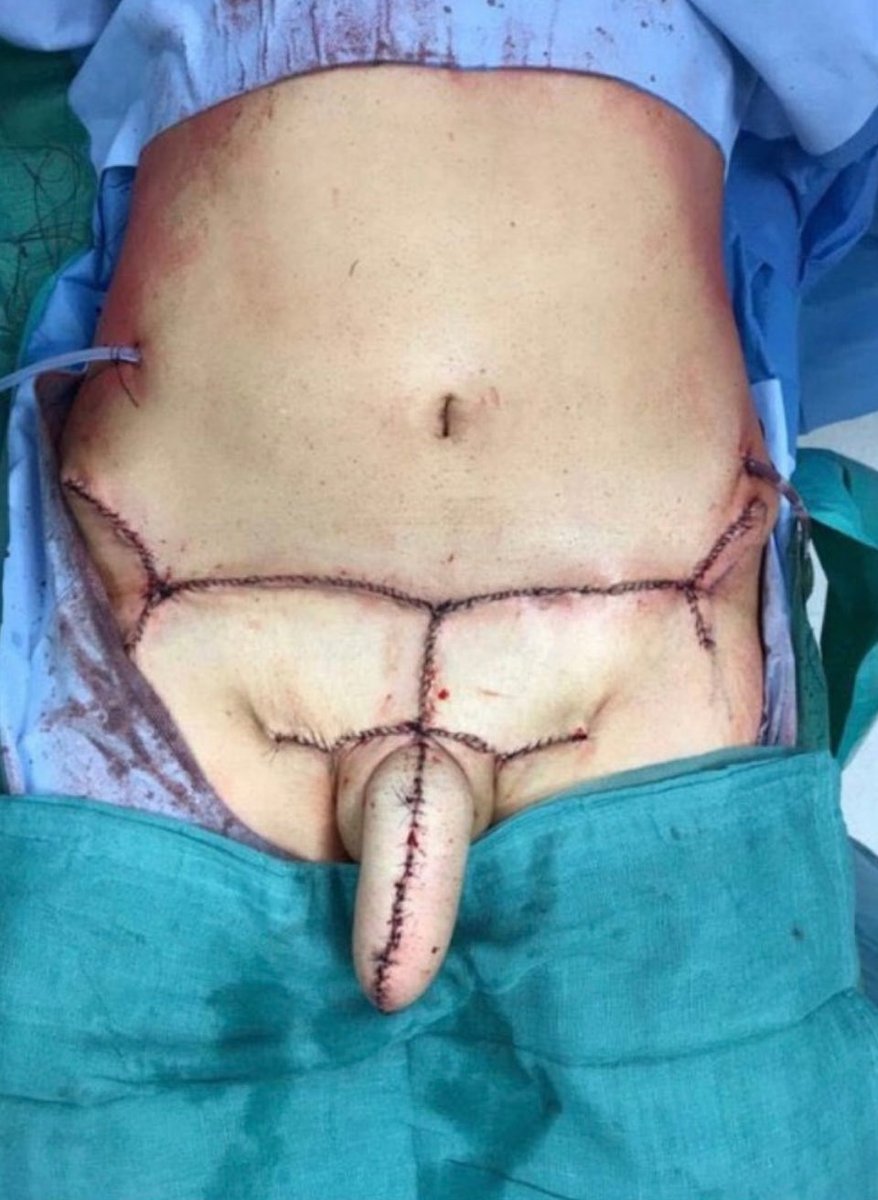 Garbage Human tweet media