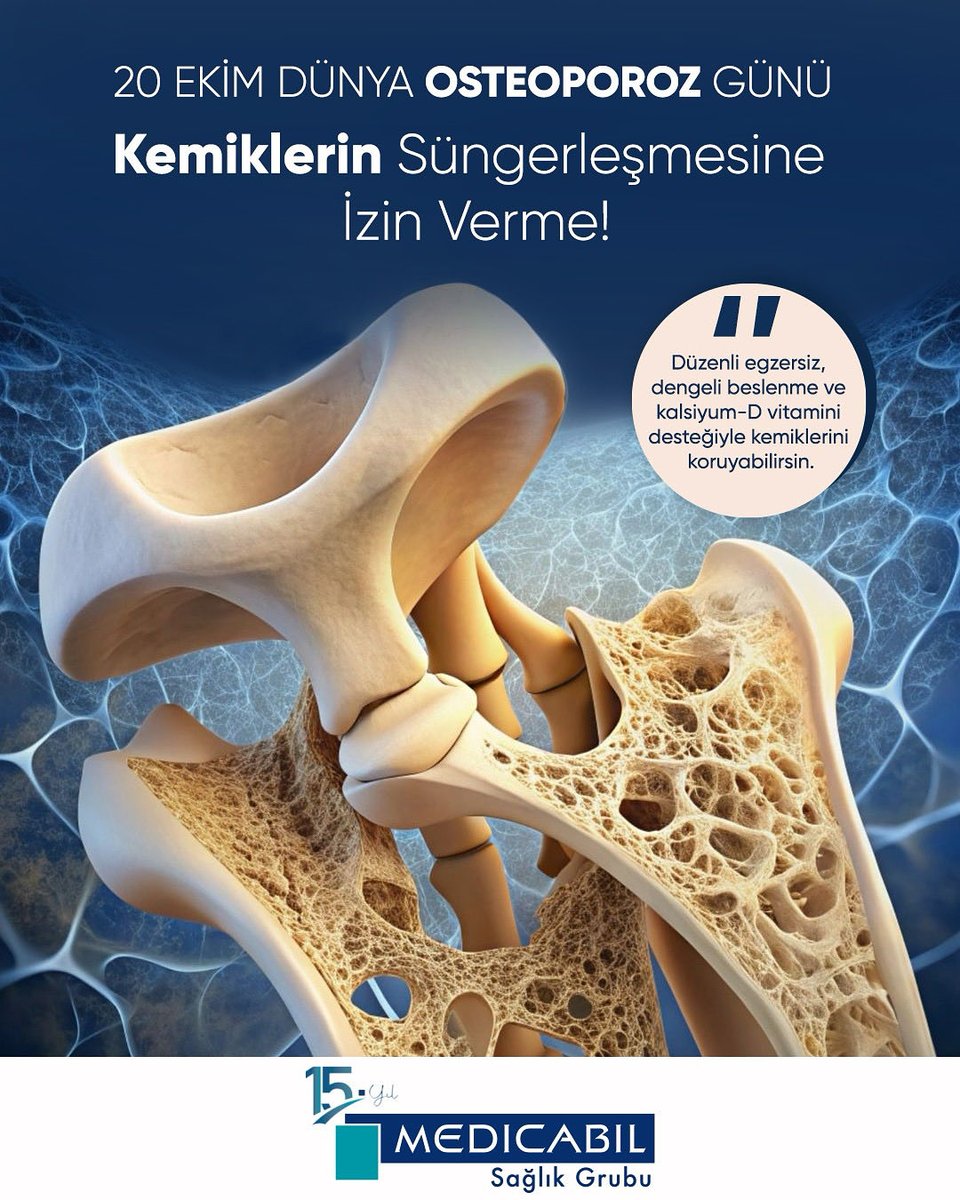 Medicabil's tweet image. Kemiklerin Süngerleşmesine İzin Verme!

Osteoporoz, sessiz ilerleyen ama ciddi sonuçlara yol açabilen bir kemik hastalığıdır. Erken tanı, doğru beslenme, egzersiz ve düzenli kontrollerle önlenebilir ya da ilerlemesi yavaşlatılabilir.

#20EkimDünyaOsteoporozGünü