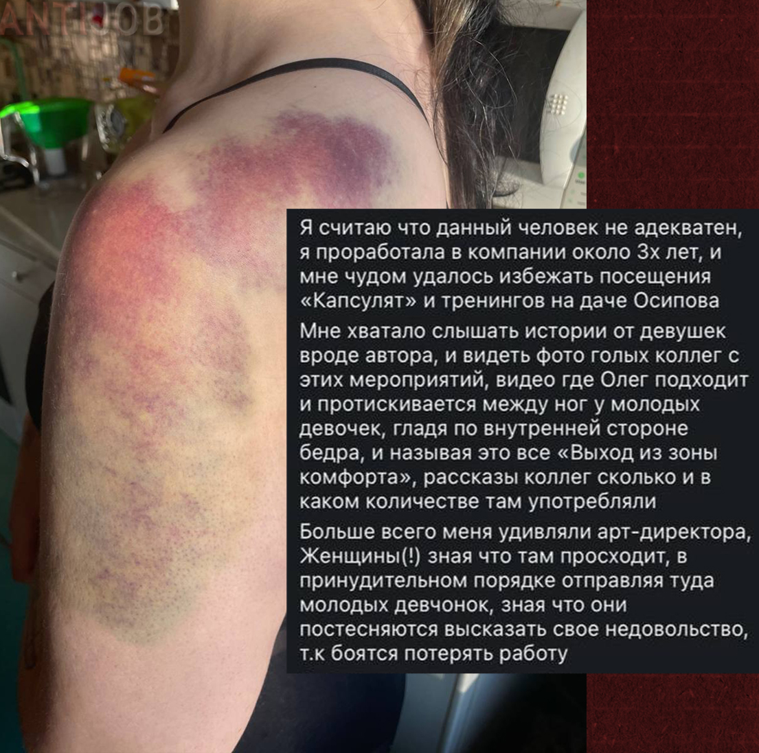 Руководство сети парикмахерских в Петербурге проводит для персонала «тренинги» с публичным оголением и насилием

Сотрудники сети имидж-студий CAPSULAhair в Санкт-Петербурге видели некоторый «тимбилдинг».

Несколько бывших мастеров рассказали, как их работодатель проводит тренинги