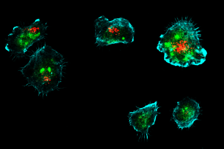 🧬A new Science Immunology study by CeMM, <a href="/StAnna_CCRI/">St. Anna Children's Cancer Research Institute CCRI</a>, <a href="/MedUni_Wien/">MedUni Wien</a>, <a href="/MedUniGraz/">Med Uni Graz</a> &amp; <a href="/UniBonn/">Rheinische Friedrich-Wilhelms-Universität Bonn</a> uncovers a surprising link between lipid biology &amp; immune defense, with insights for rare immune disorders &amp; cancer immunotherapy.
➡️tinyurl.com/2ant228p
📄tinyurl.com/yrbzt7st