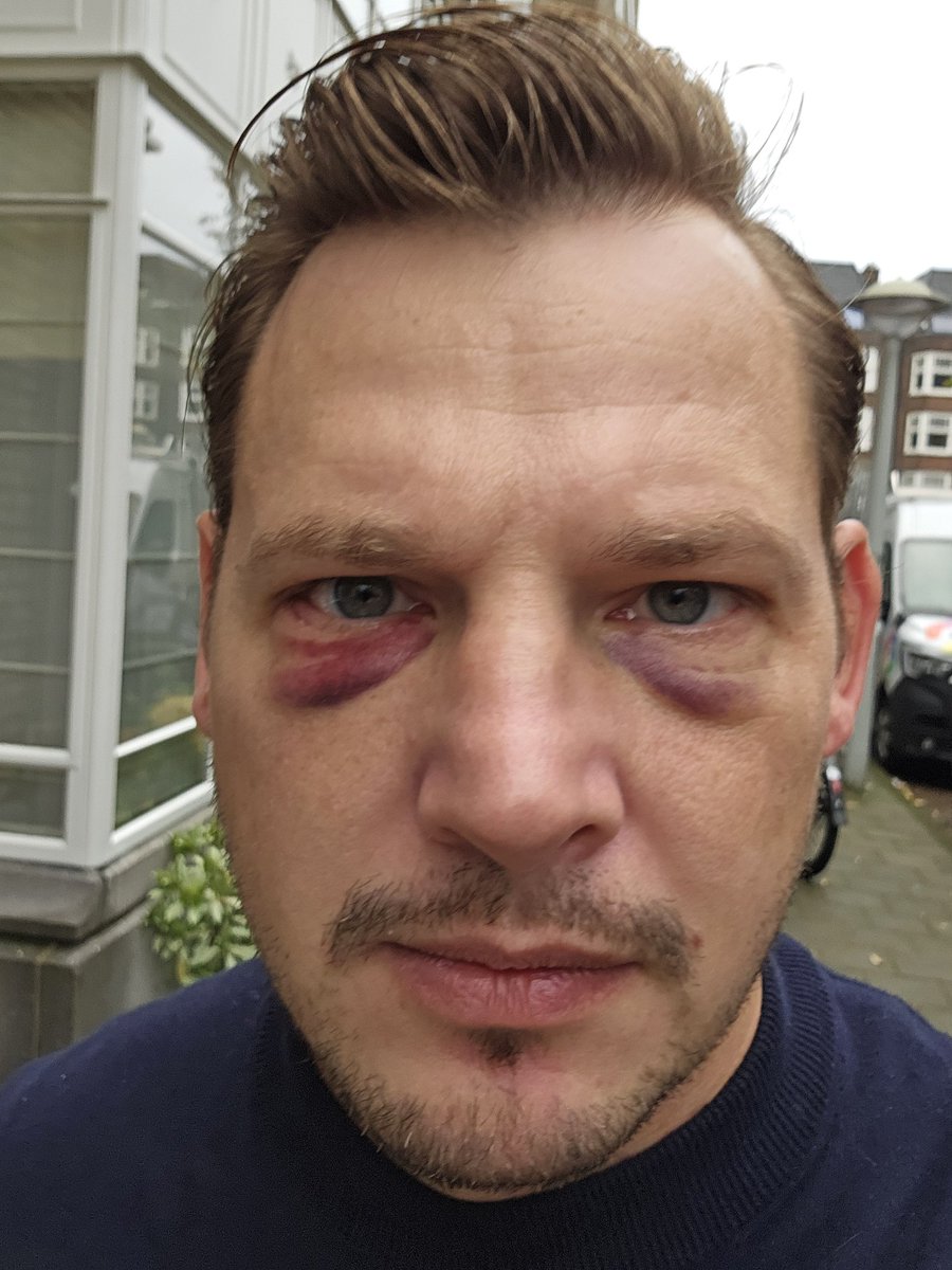 Arno About tweet media