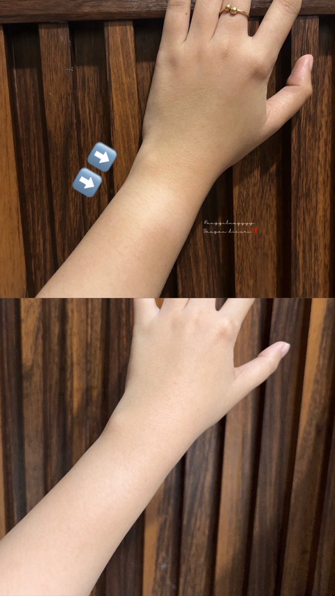 panggilnayyyy's tweet photo. girls problem                 the solutions https://t.co/W6JkO1zq38