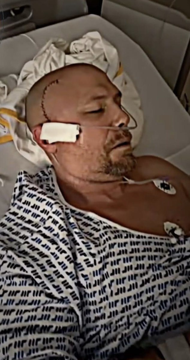 Fs_francaises_'s tweet image. Philippe est toujours hospitalisé suite à cette maladie grave au cerveau.

Une pensée pour lui et ses proches. Tout notre courage Philippe !