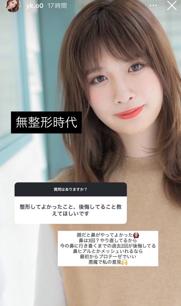 （※プロフ必須） プロフ必見 adidas ZX 7000 30 Years of Torsion (2019