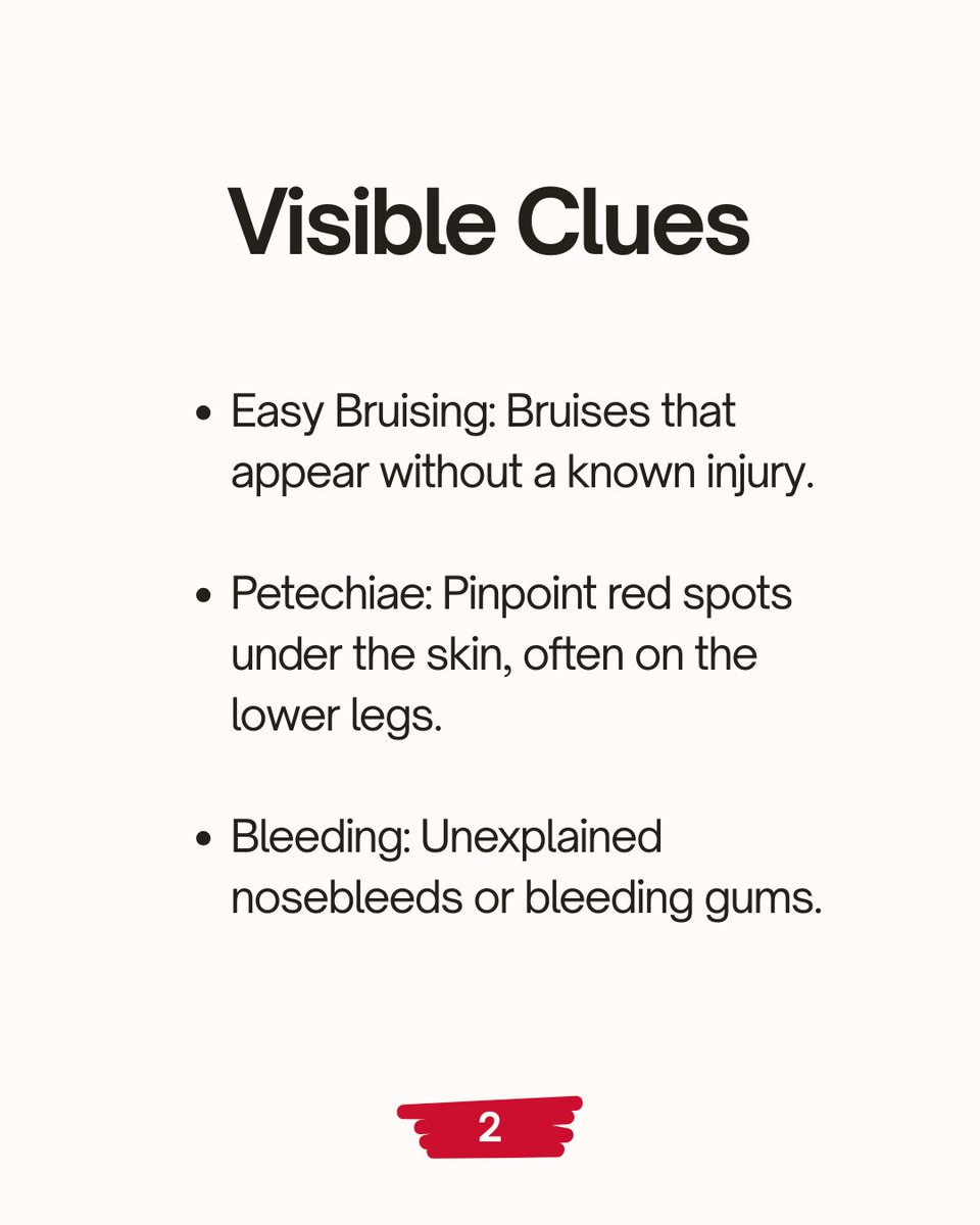 ITPSupportAssoc's tweet image. Understanding ITP: The Common Symptoms 💜
ITP affects everyone differently, but recognizing common symptoms is a vital step in managing the condition. Swipe through to learn more about the signs that often lead to a diagnosis or require attention.
From visible clues like easy…