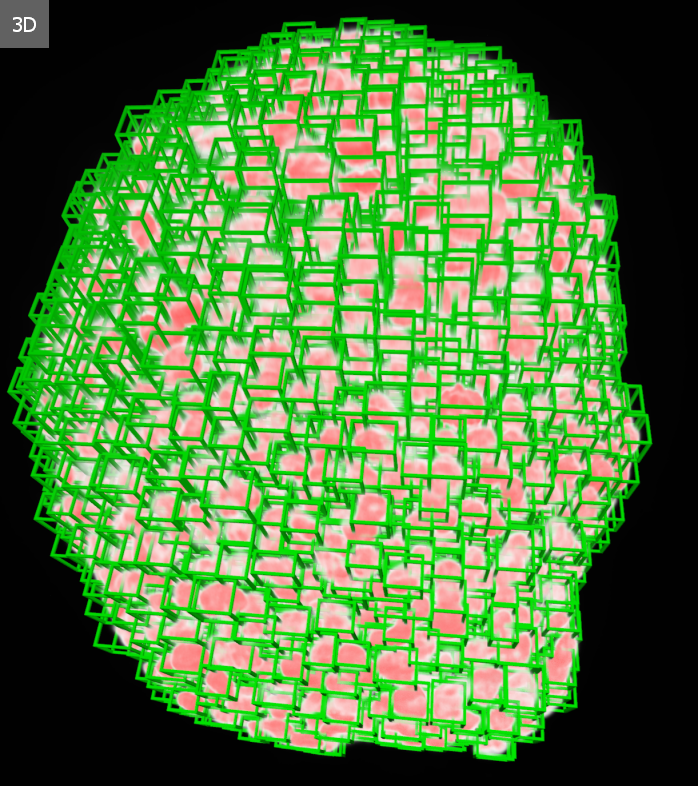 hunren_science's tweet photo. Forradalmi 3D-sejtanalízis Szegedről. Dr. Horváth Péter kutatócsoportja AI segítségével ellátott rendszerrel forradalmasíthatja a személyre szabott gyógyítást. A #HUNREN #SZBK-ban kifejlesztett technológia akár 100 beteg sejtmintáját képes vizsgálni. https://t.co/asbqRG2tKI https://t.co/YecUgF4jpV