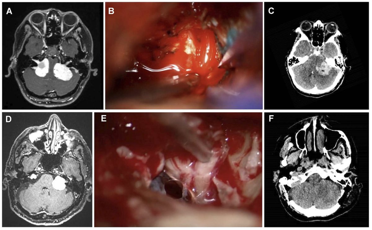 Mayo Clinic ENT tweet media