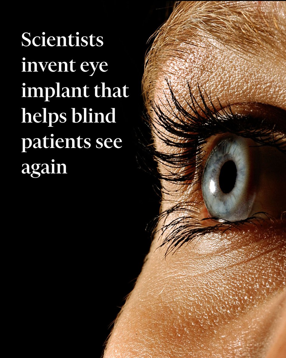FT's tweet photo. The device helped 81% of trial participants suffering from advanced age-related macular degeneration (AMD) to achieve clinically meaningful improvements in their vision. https://t.co/2aJSPhJLGu https://t.co/btR0K3muh7