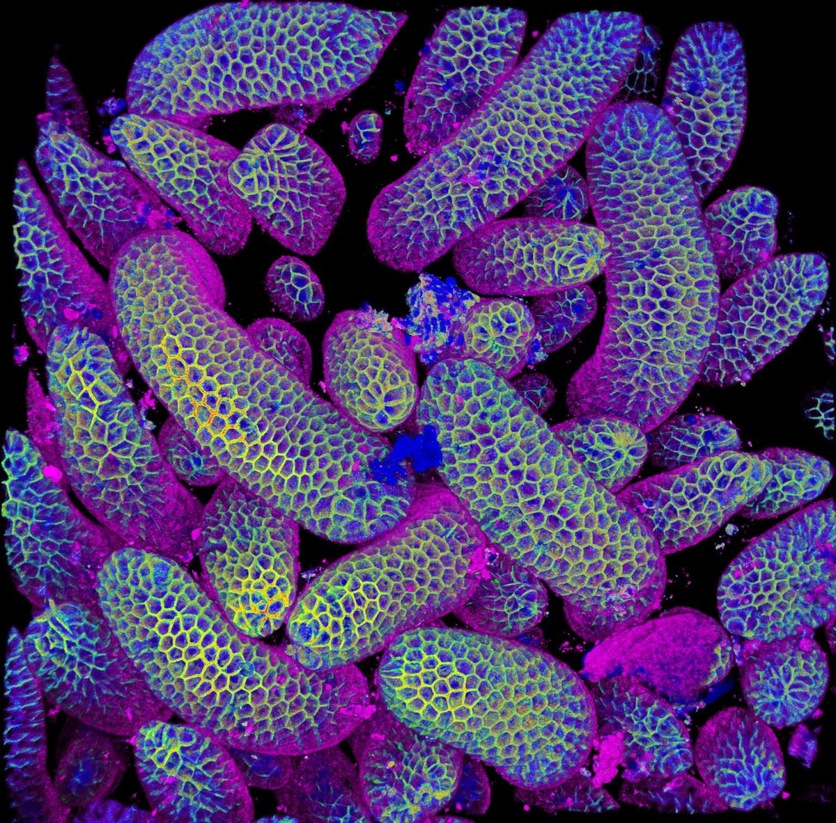 Microscopy Image Competition 2025 Finalists

There are two categories:
Category 1: Featuring Proteintech antibodies
Category 2: Featuring any antibodies

The images below are the Category 2 finalists.

Vote before Oct 26 (T&amp;Cs apply): ow.ly/qhK350XeWNi