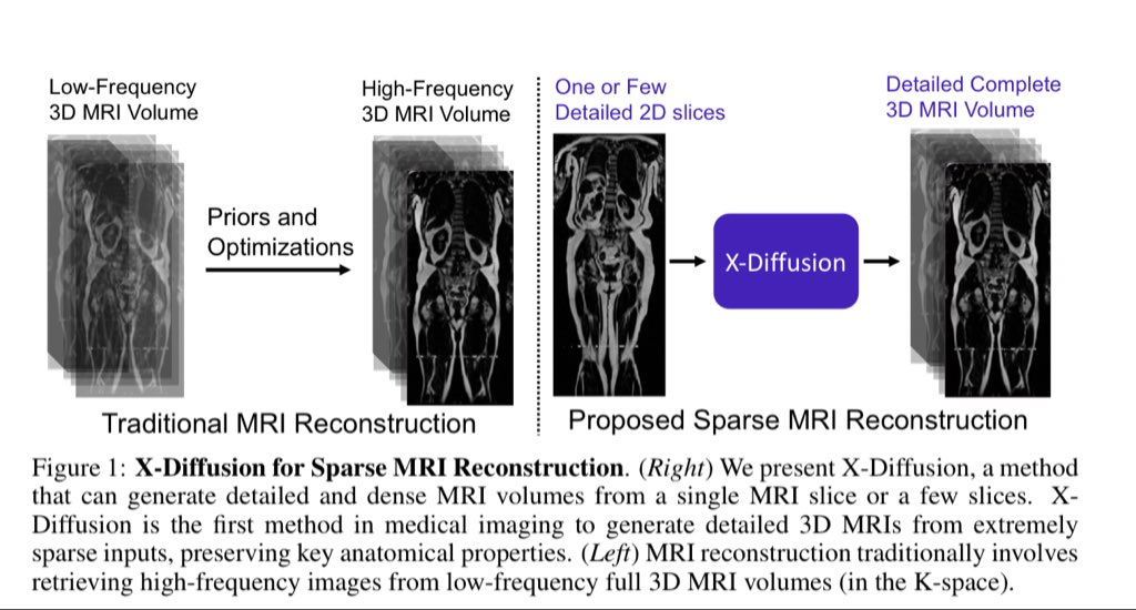 If you are attending #ICCV2025 this week please check our 3 main conference papers and 1 oral paper at the workshops covering topics on spatial intelligence and medical imaging 

1- UKBOB : the biggest 3D MRI segmentation dataset of over 1 billion labeled masks + SOTa foundation