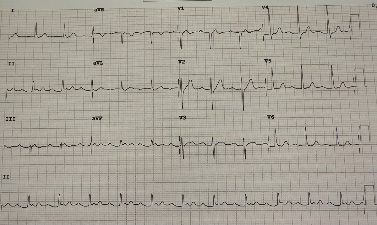 Julian P Villacastin tweet media