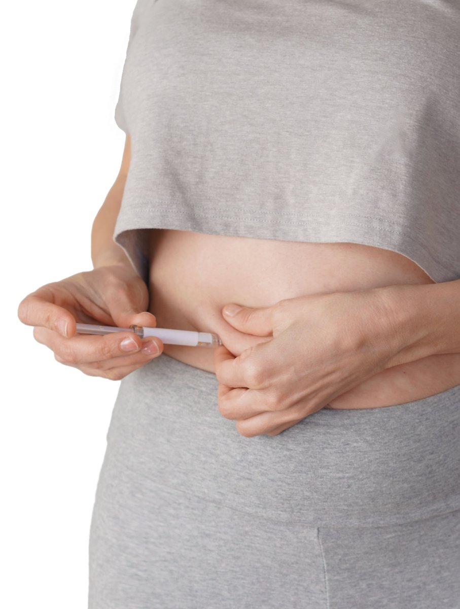 UPMCnews's tweet image. Online companies are selling unregulated weight loss drugs. @UPMC Obesity Medicine specialist Dr. Noor Khan talked with @MedPageToday about why this is so dangerous. medpagetoday.com/popmedicine/cu…
#weightloss #GLPs #weightlossdrugs