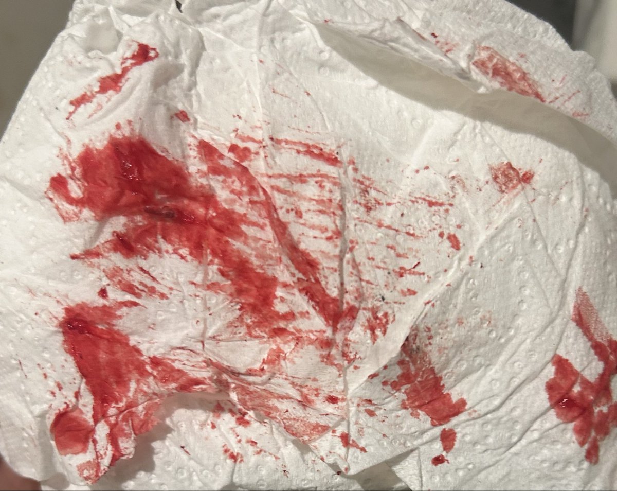 LikeToast40802's tweet photo. Can we appreciate these cuts (these were in September) #selfharmm #shtwt #shedtwt #selfinjuryy #blood  #styros #annie #deb #depression #988twt #suicidetwt #cuts https://t.co/AThfOR1vZ0