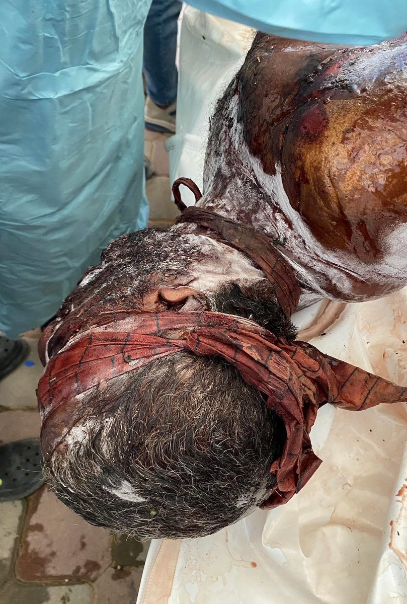 Blindfolded, bound, and mutilated—bodies showing torture and execution. Among 150 corpses, families searched in despair for loved ones; one man compared teeth to a photo of his brother, another wife recognized her husband by his clothes. At Nasser Hospital in Khan Younis, grief