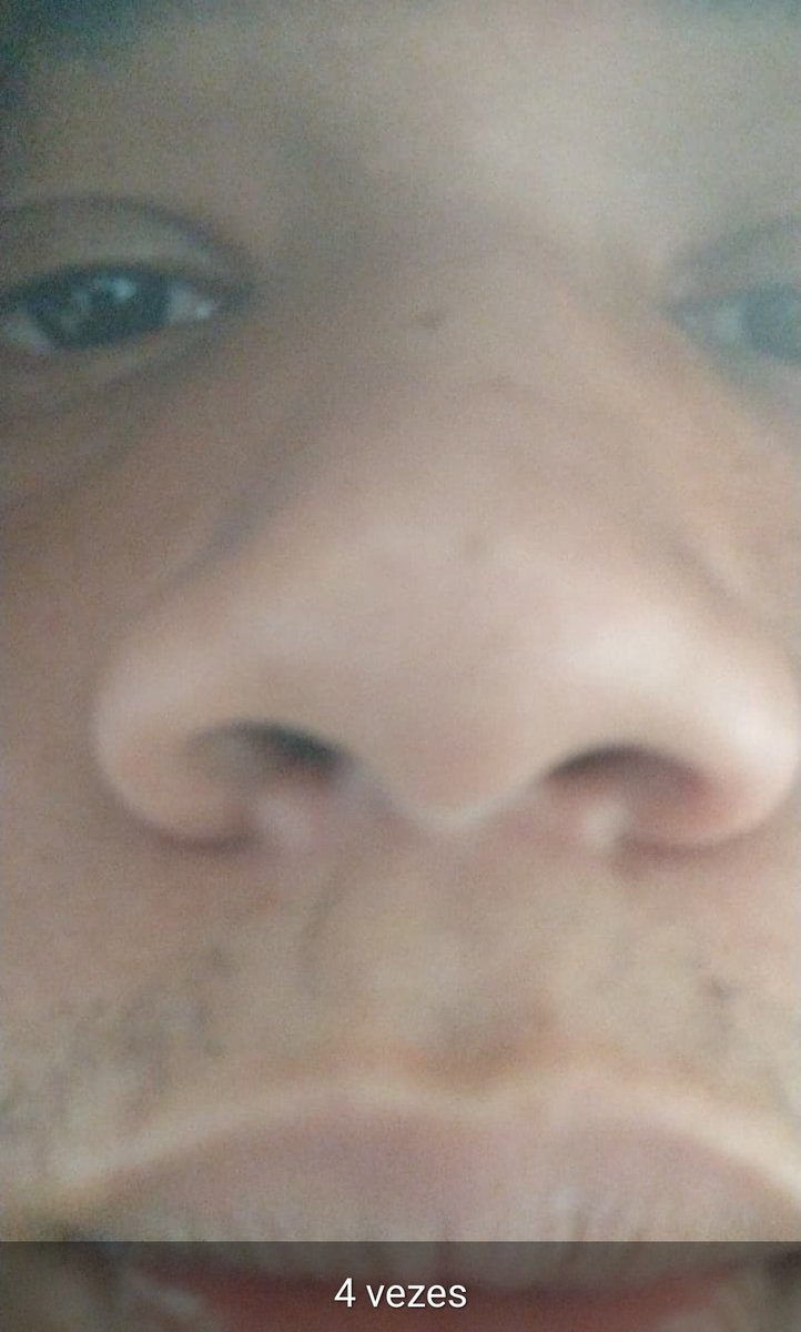 liroualbert's tweet photo. Betozoom 4x https://t.co/q8HtUUd7BD