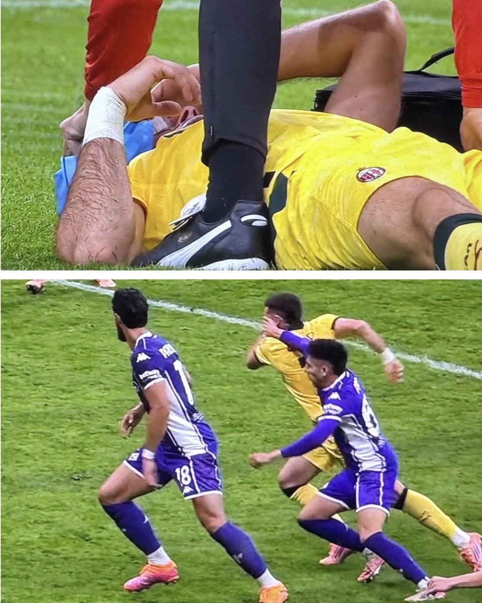 Carezza a sx e medicato a dx 🤡🤡