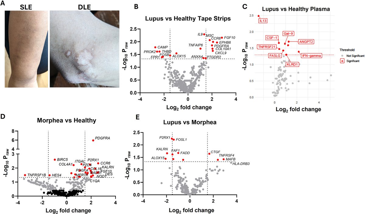 Leveraging #technology to improve participation in clinical trials using tape and a wearable blood collection device--a new era may be dawning ow.ly/Pntc50XeVW7 #medderm #dermtwitter