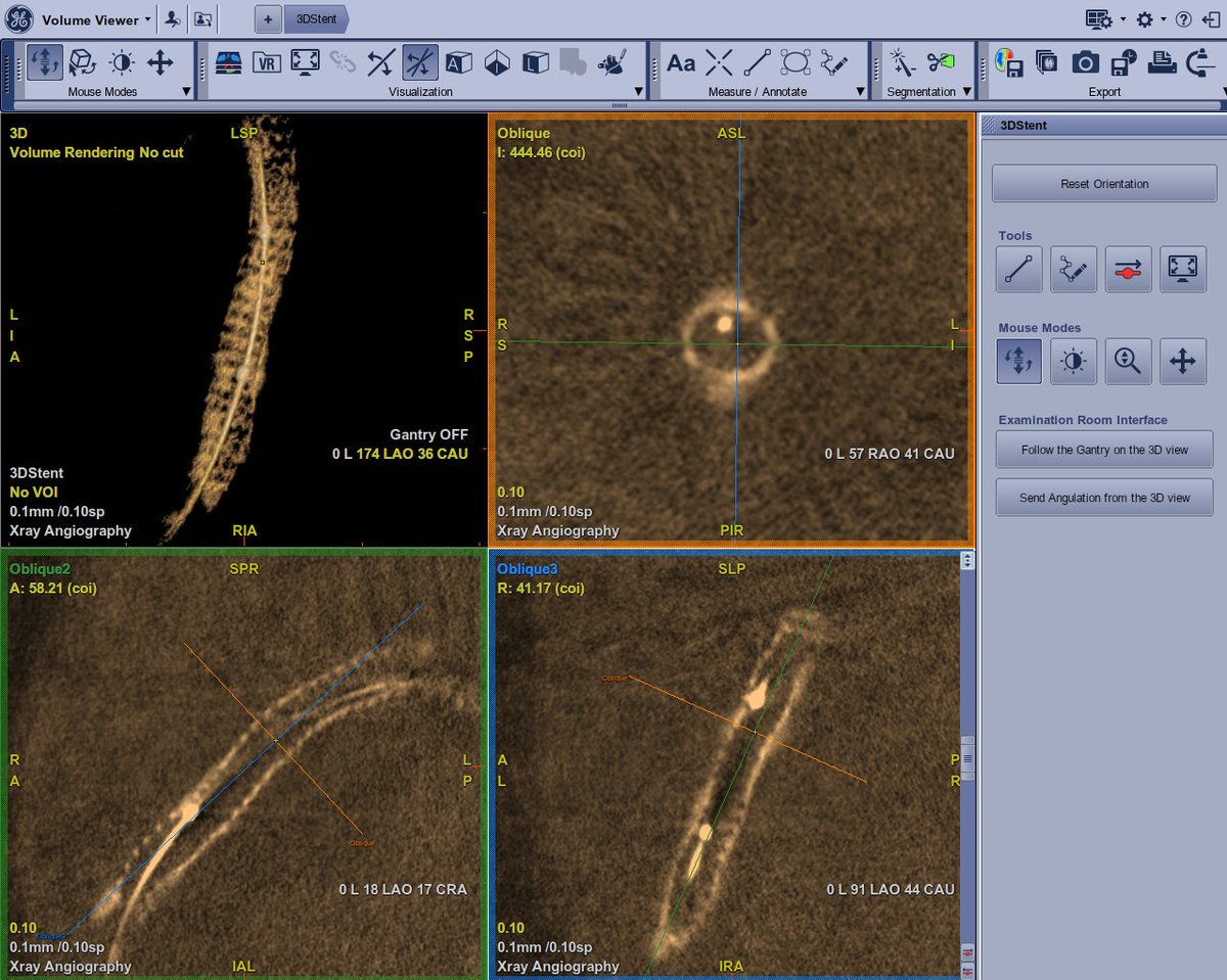 Mohammed Y. Alateeq | محمد بن يوسف العتيق tweet media