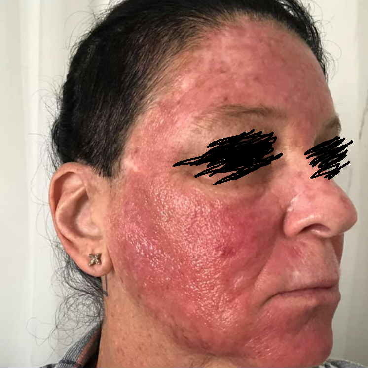 Anti-Skin Cancer Warrior tweet media