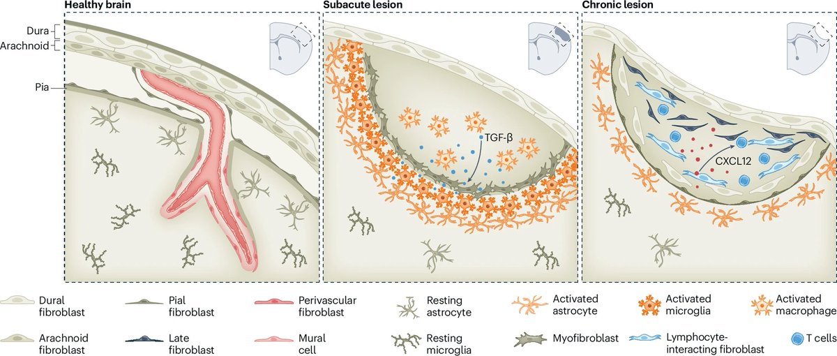 Brain fibroblasts are dynamic regulators of tissue repair and immunomodulation after injury, with implications for understanding scar formation, function and long-term outcomes of acute brain injuries <a href="/NatImmunol/">Nature Immunology</a> <a href="/costantinoiade1/">costantino iadecola</a>
nature.com/articles/s4159…
nature.com/articles/s4158…