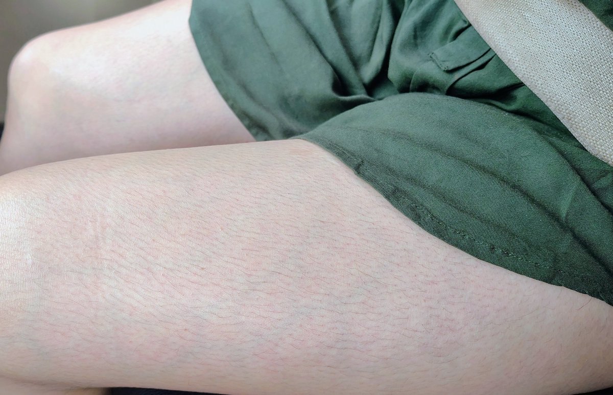 Canymar01 tweet media