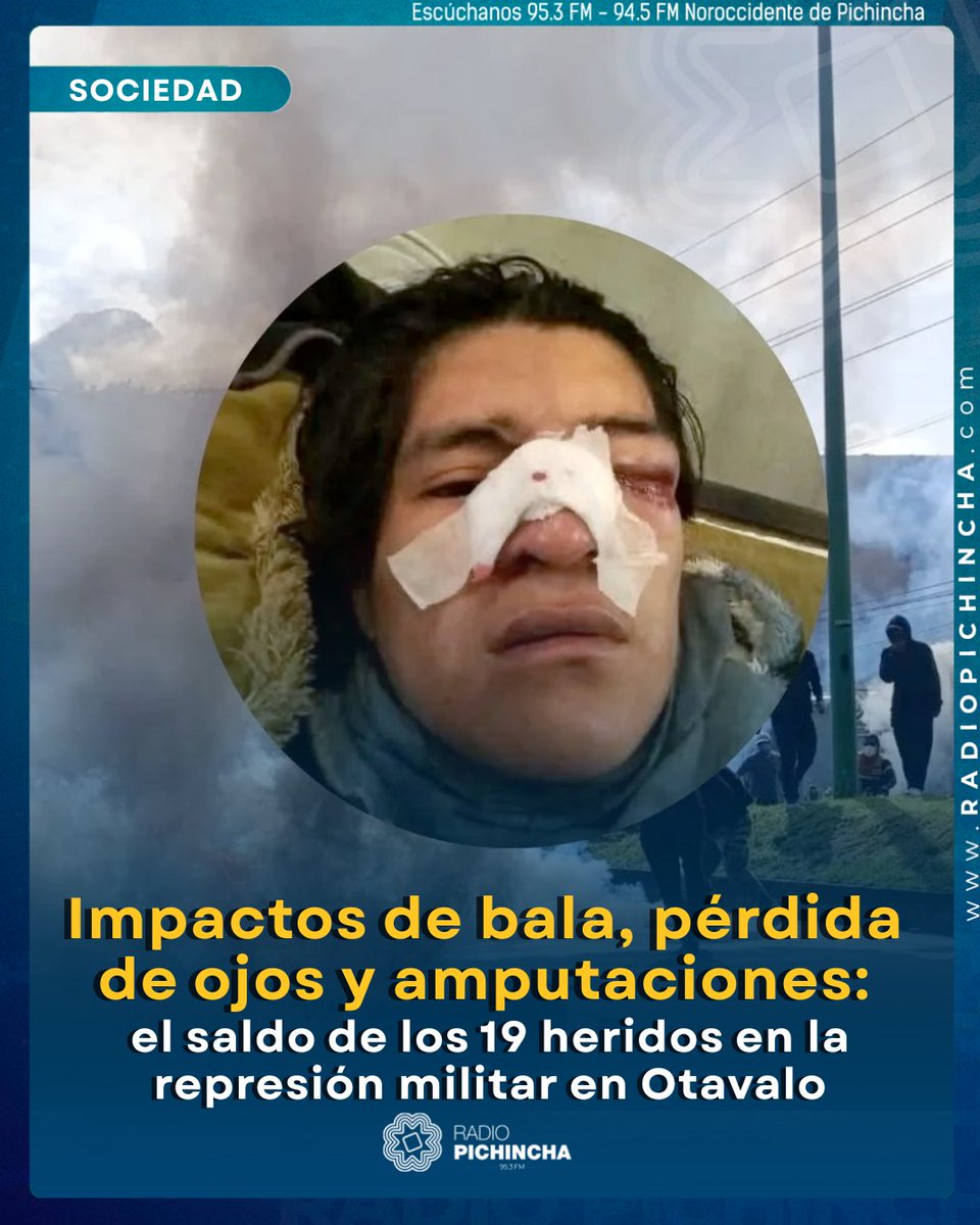 👥#SOCIEDAD | Decenas de personas resultaron gravemente heridas por impactos de bala, perdigones y bombas lacrimógenas, según un registro elaborado por familiares y organizaciones locales.
Las víctimas pertenecen en su mayoría a comunidades indígenas como Peguche, San Pedro,