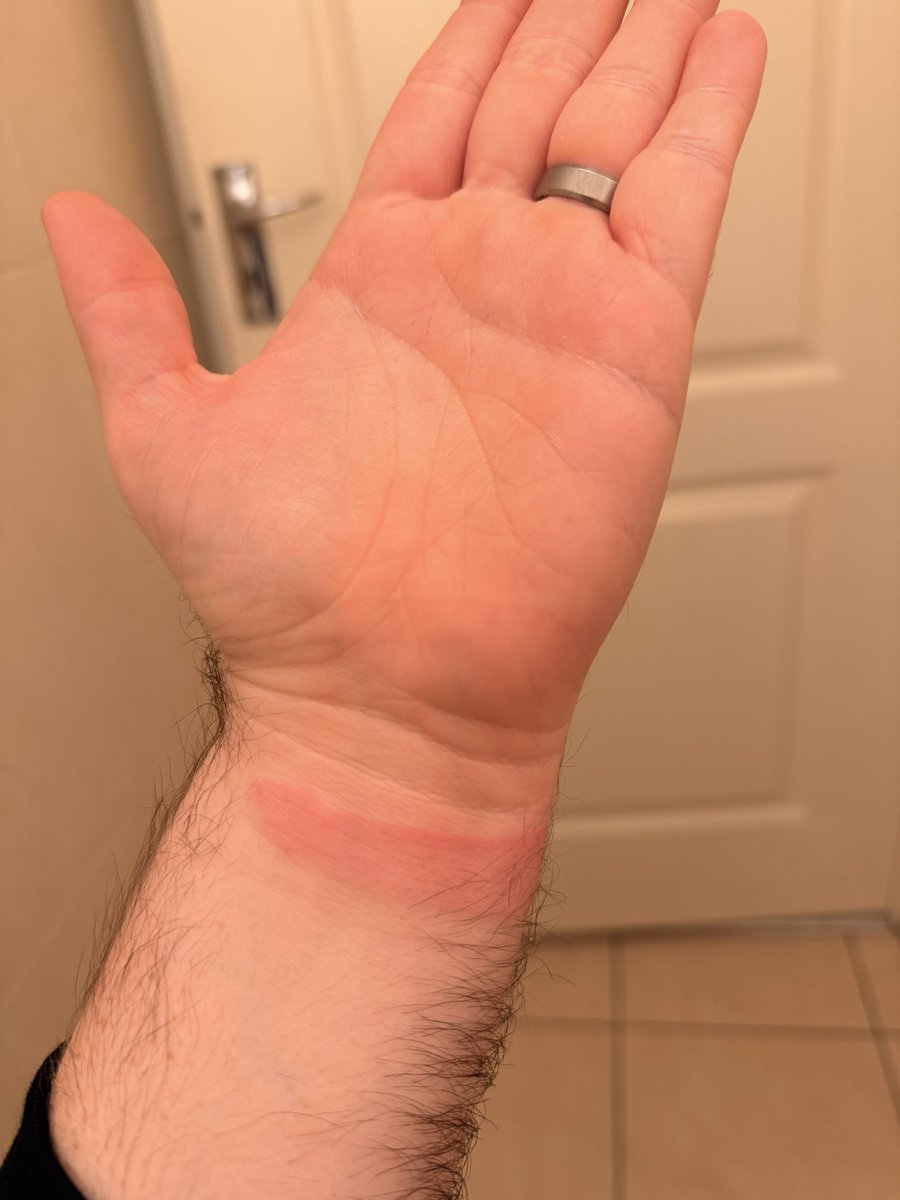 First time I’ve had one of the sports bands do this to me 😳

Wonder if Apple have put a new coating on them or something 💭