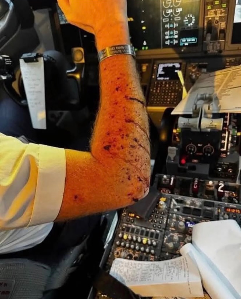 RealDanODowd's tweet image. Over 66% percent of satellites in low earth orbit are SpaceX’s. In LEO there is still enough atmosphere to ensure that everything eventually returns to earth.
In this example, what the pilot described as 'space debris' smashed into the windshield of a Boeing 737, leaving shards…