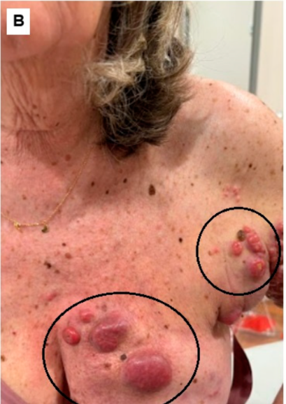 Anti-Skin Cancer Warrior tweet media