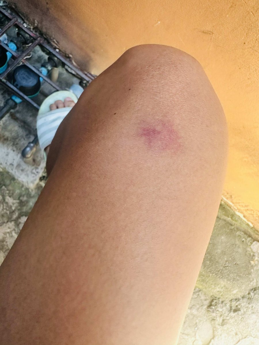 RiderPasig's tweet photo. Effect ng NEO at UPd last weekends.. ππ Wag kung anu anu iniisip.. nasagi lang yan sa motor.. ahaha
OUTDOOR YARN ?? πππ¦π€€
#alterpasig #altermarikina #AlterQC #alterdiliman #alterupd #altercainta #alterantipolo #altermanila #alterph #jakolph https://t.co/xZHQJRlmNj