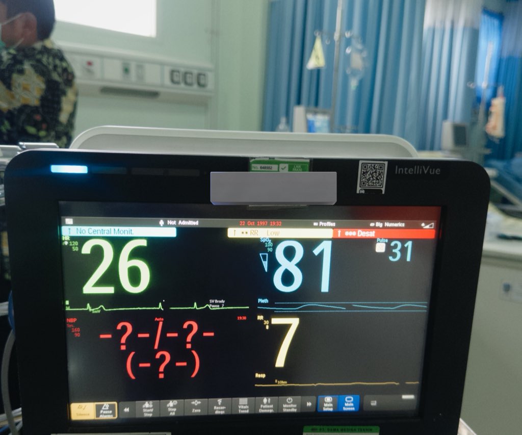 eskepalmilosatu's tweet image. Hari ini dapet pasien dari IGD, mau hemodialisis (cuci darah). Datengnya udah lemah banget, tensi drop, nafas juga berat, pake ventilator (mesin bantu nafas).
Cuci darah baru jalan 1,5 jam, tiba-tiba tensi ngga kebaca, nadi pelan banget 26x/menit, saturasi oksigen cuma 81% on…