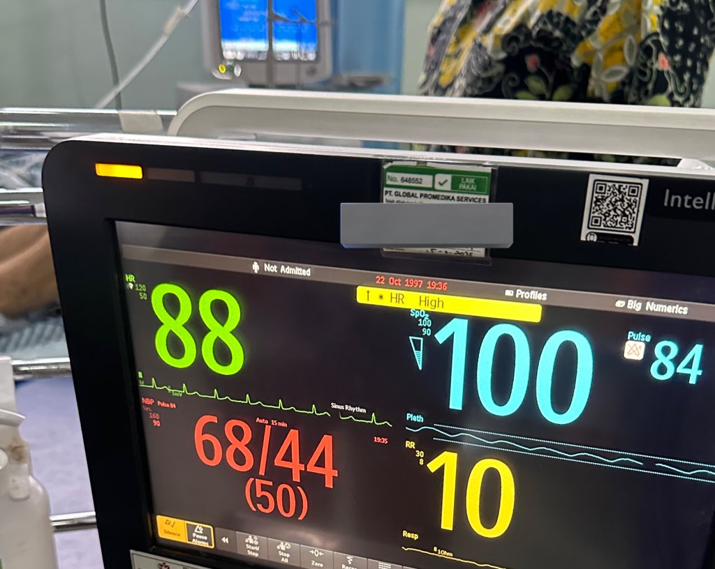eskepalmilosatu's tweet image. Hari ini dapet pasien dari IGD, mau hemodialisis (cuci darah). Datengnya udah lemah banget, tensi drop, nafas juga berat, pake ventilator (mesin bantu nafas).
Cuci darah baru jalan 1,5 jam, tiba-tiba tensi ngga kebaca, nadi pelan banget 26x/menit, saturasi oksigen cuma 81% on…