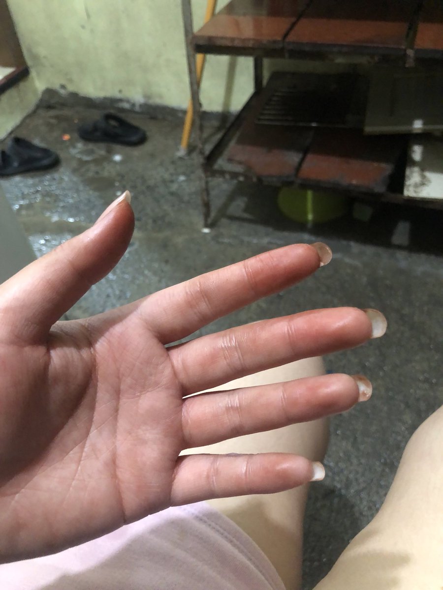 scanningthecode's tweet image. ang sabi kasi mag-gloves… :))