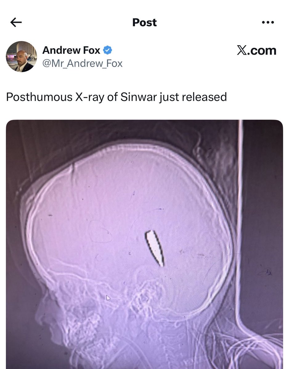 He makes jokes about X-rays of Palestinian children shot in the head by Israeli soldiers.

Yes, I do have an issue with him.

Because I’m not a psychopath.