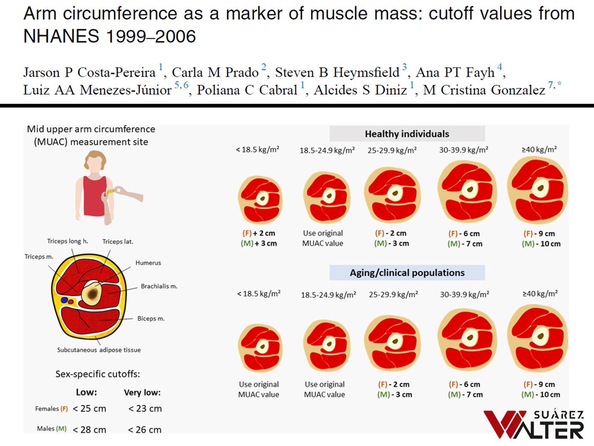 PERÍMETRO DE BRAZO COMO MARCADOR DE MASA MUSCULAR

¡¡¡A leer, zagales!!!

waltersport.com/investigacione…