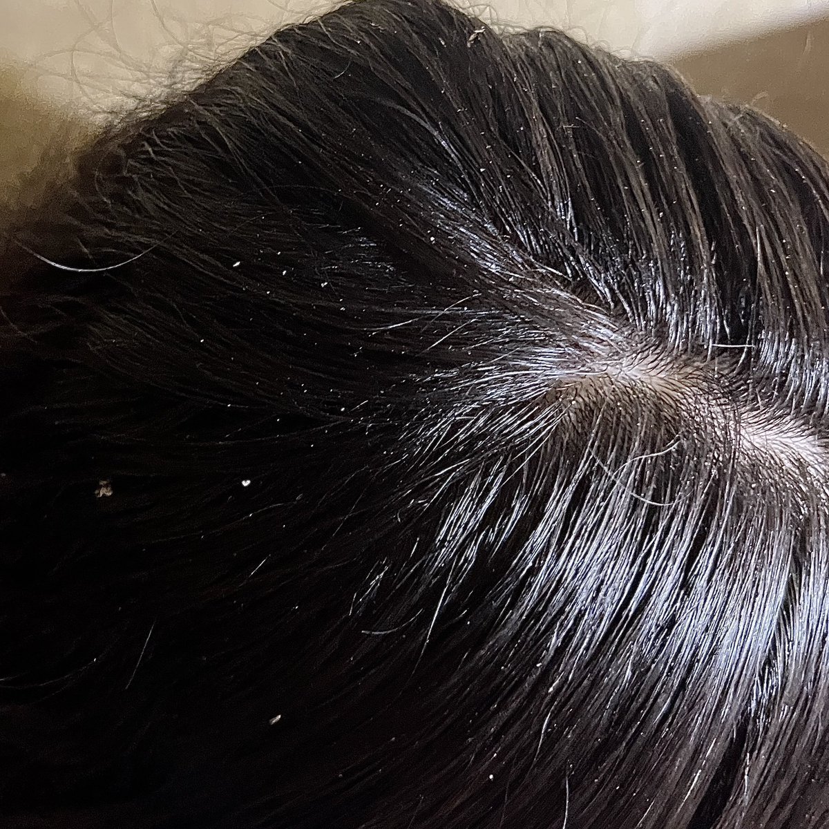 hibi 🦋 (@hlogwarts) on Twitter photo shampoo vegan dan NON SLS dari produk lokal Dr Soap yang nampol detoks kulit kepala!
isinya banyak 400ml, bikin ketombe basah lengket dan ketombe kering bersih! ga bikin rambut ngembang, cocok buat yang rambutnya kena proses kimia👍🏻
🖇️: s.shopee.co.id/60J9Z66mZz shampoo vegan dan NON SLS dari produk lokal Dr Soap yang nampol detoks kulit kepala!
isinya banyak 400ml, bikin ketombe basah lengket dan ketombe kering bersih! ga bikin rambut ngembang, cocok buat yang rambutnya kena proses kimia👍🏻
🖇️: s.shopee.co.id/60J9Z66mZz