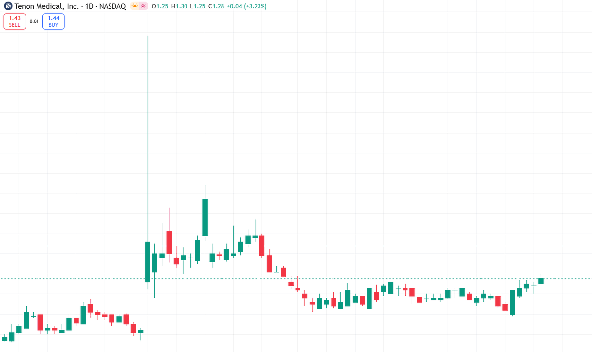 Today's Stock Recommendations

$TNON

Momentum strengthens after FDA expands approval of Catamaran SI arthrodesis system
Acquisition of SiVantage adds new technology to Tenon's sacropelvic product line