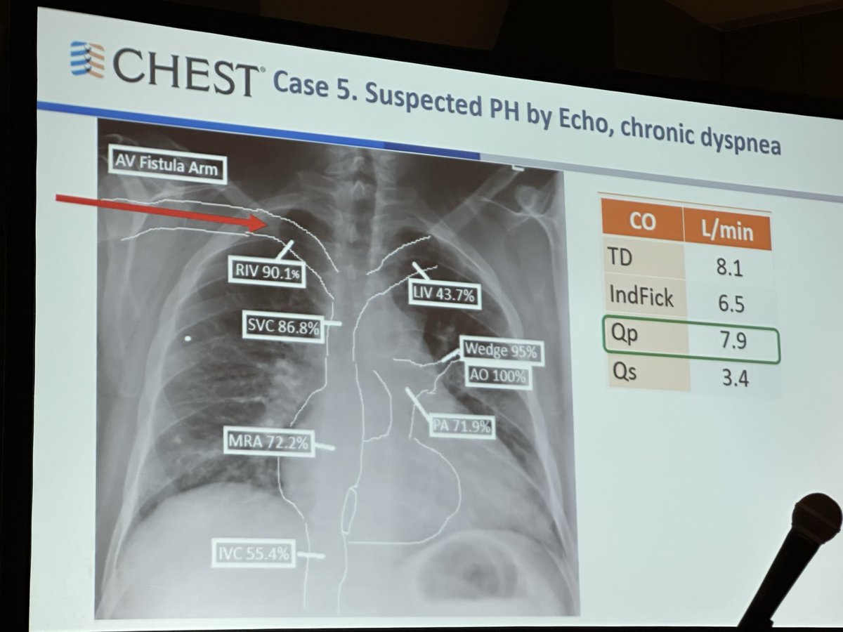 Nice summary slide on shunt runs in RHC from <a href="/FSotoMD/">Francisco Soto, MD, MS, MBA</a> 

And a really interesting case related to dialysis fistula #CHEST2025
