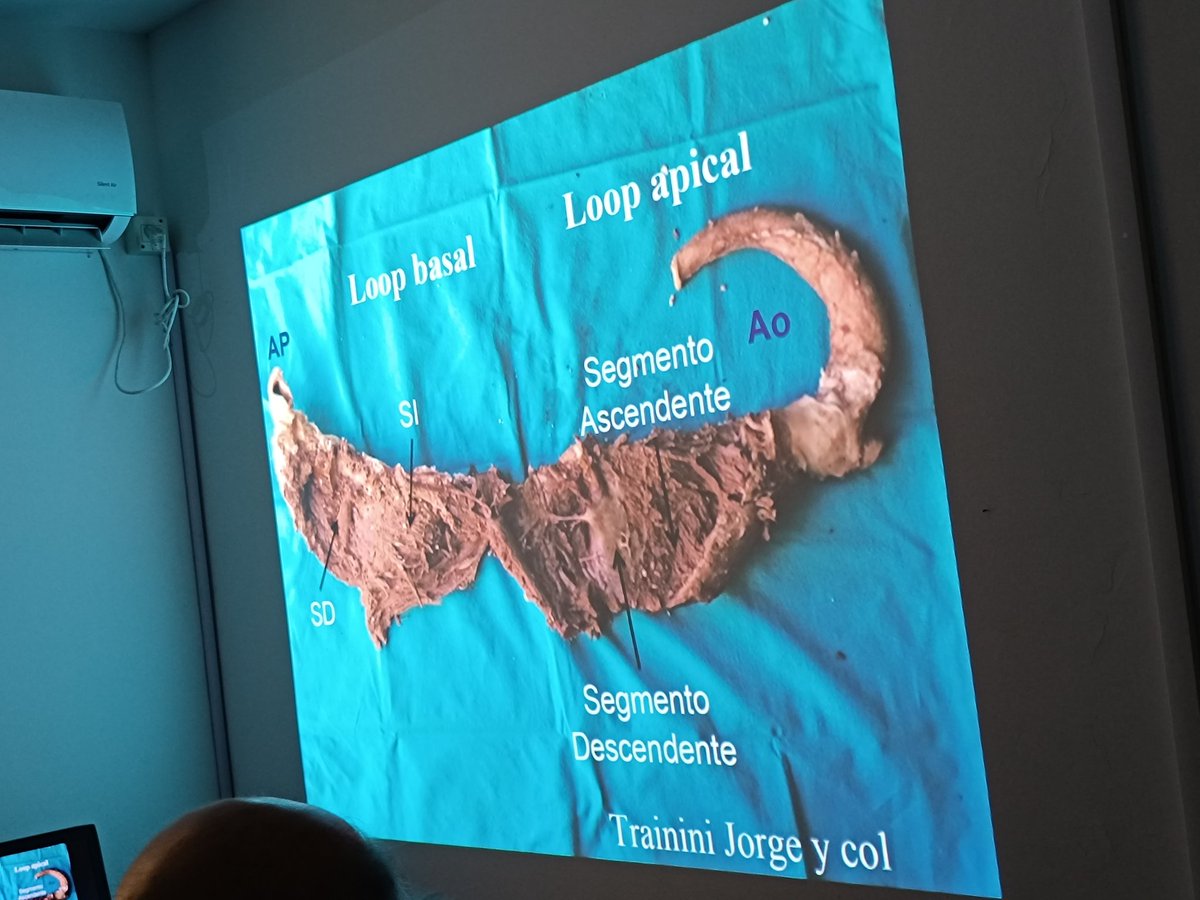 Día 2 de la Semana intensiva Cardiovascular 🫀 hoy con Conferencia del Dr Jorge Lowentein - Mecánica Cardíaca - teoría de Torrent Guasp