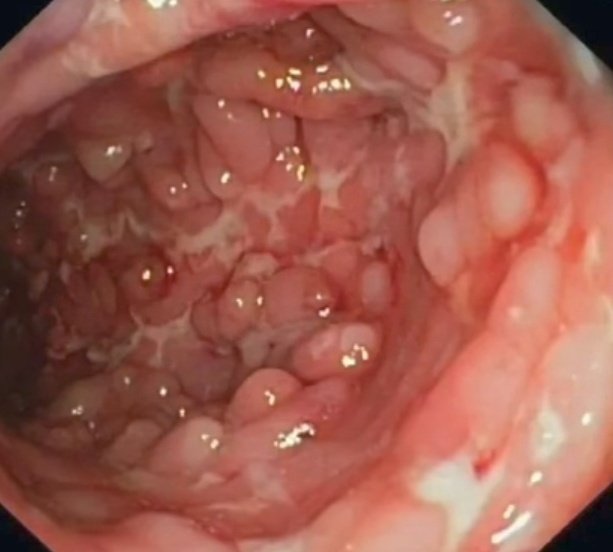 nervemed tweet media