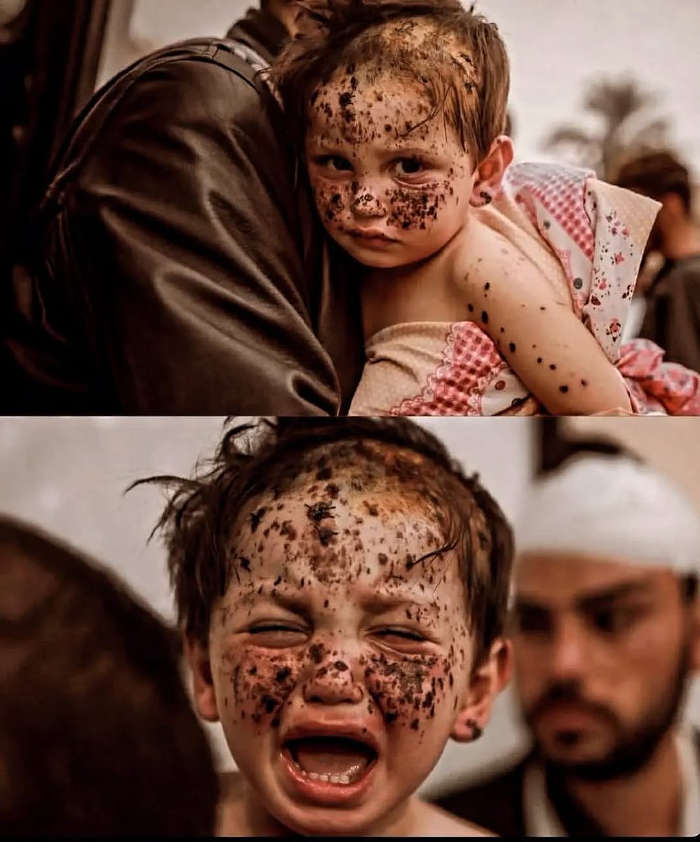 Help_Mazlum2's tweet image. Bu savaş değil, bir soykırımdır.

“Ateşkes Nerede?”
#WhereIsTheCeasefire yazıyoruz
