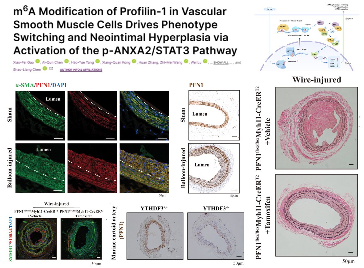 HaoYin20's tweet image. #SmoothMuscleCell m6A Epitranscriptomics

METTL3-YTHDF3 enhances Profilin-1 mRNA translation➡️
⏫SMC proliferation migration
⏬SMC contractile phenotype

METTL3 YTHDF3 PFN1 ⬆️in PDGF-BB-treated SMC &amp;amp; injured carotid artery

SMC Mettl3 or Pfn1 KO🐭➡️
⏬wire-injured carotid…