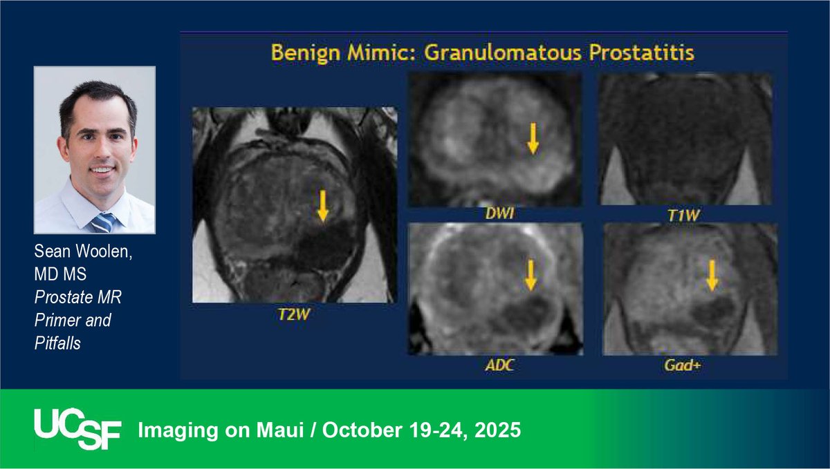 UCSF Abdominal Faculty Dr. Sean Woolen reviews Prostate MRI to start off our week on MAUI. radiology.ucsf.edu/cme