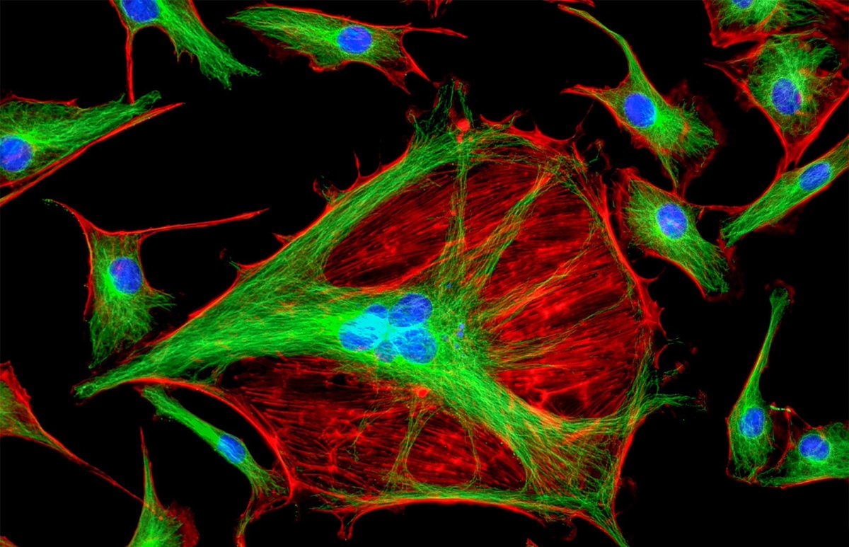 AZoSensors's tweet image. Cells that create their own glowing amino acids reveal enzyme activity in real time✨ Lighting up enzyme activity could prove to be significant in drug discovery and live-cell research. azosensors.com/news.aspx?news… #BioImaging #Biotech #AZoSensors